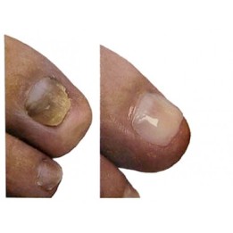 Gehwol nail repair gel beige 5ml (Opal) | Beautywaves