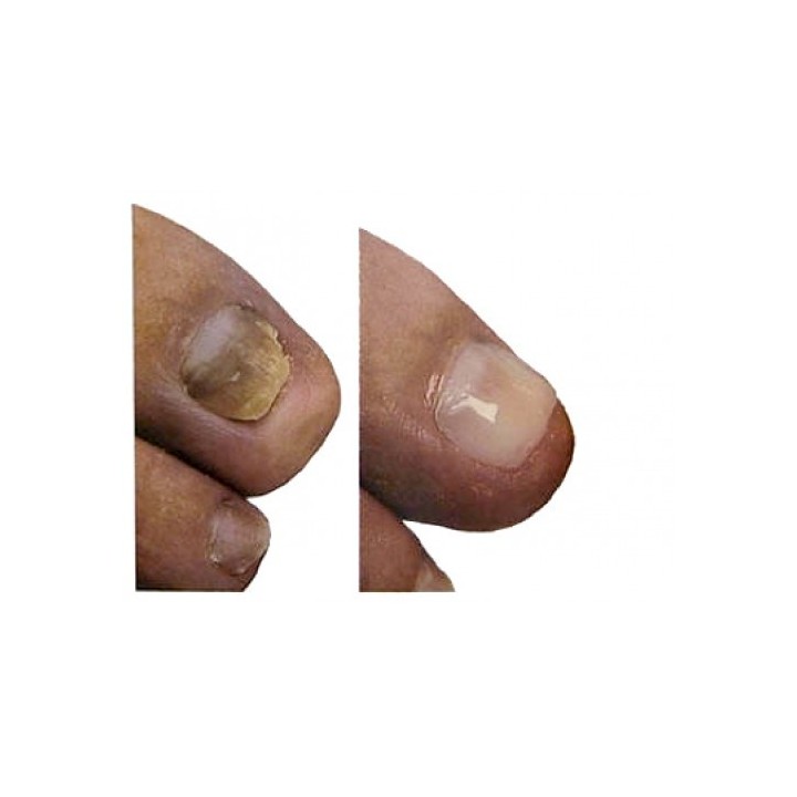 Gehwol nail repair gel beige 5ml (Opal) | Beautywaves