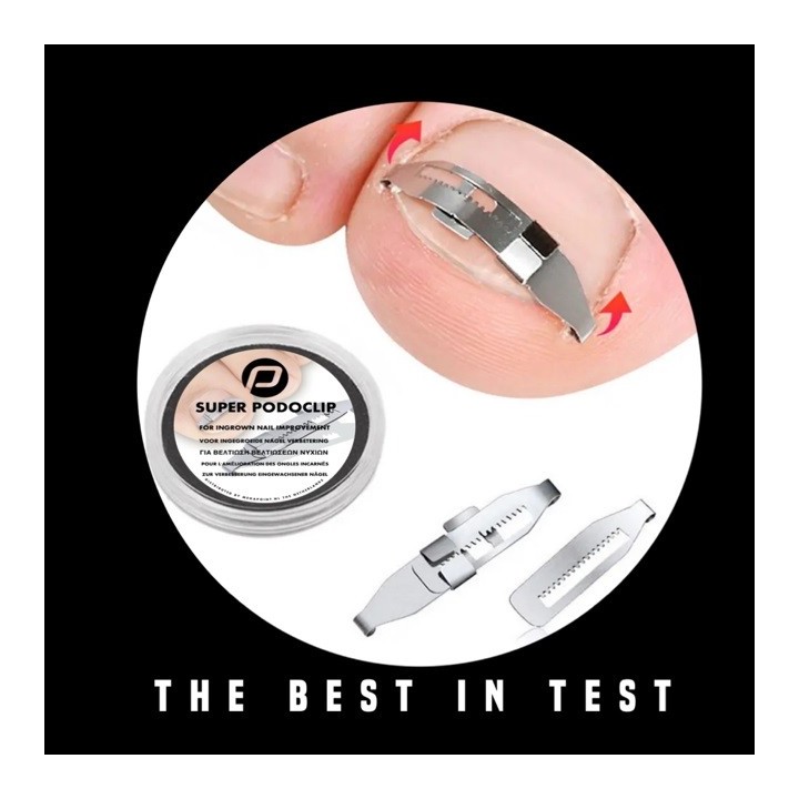 Super Podoclip Nagelbeugel Techniek