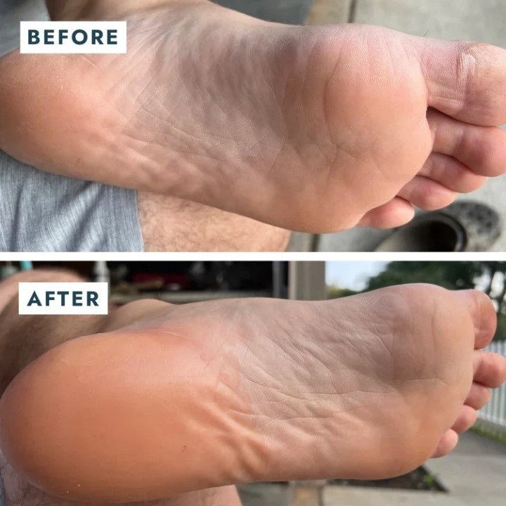 Voesh Solemate Heel Repair Balm