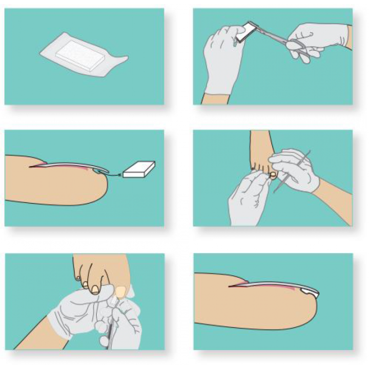 ligasano wondverband