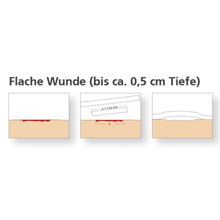 Ligasano Drukvrij wondverband | Beautywaves