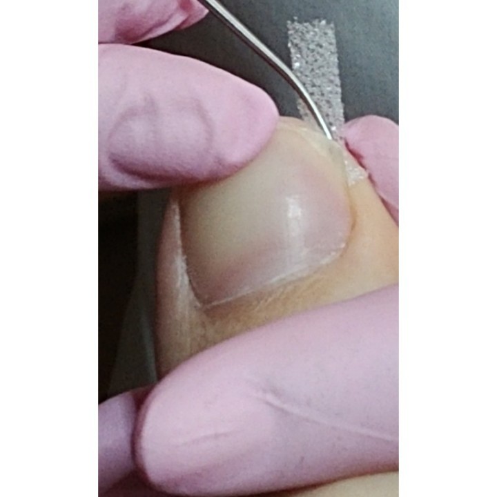 LIGASANO Wit Steriel 6 x 2.5 x 0.4 CM